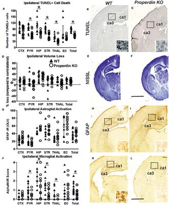 Properdin: A Novel Target for Neuroprotection in Neonatal Hypoxic-Ischemic Brain Injury